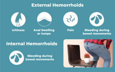 Why do hemorrhoids get worse with age?